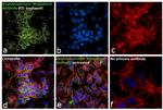 Angiotensinogen Antibody in Immunocytochemistry (ICC/IF)