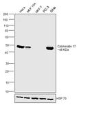 Cytokeratin 17 Antibody in Western Blot (WB)