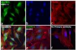 VEGF Receptor 3 Antibody in Immunocytochemistry (ICC/IF)