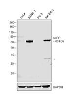 Placental Alkaline Phosphatase Antibody in Western Blot (WB)