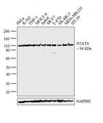 STAT6 Antibody in Western Blot (WB)