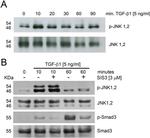 SMAD3 Antibody in Western Blot (WB)