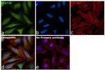 STAT5 beta Antibody in Immunocytochemistry (ICC/IF)