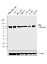 HK2 Antibody in Western Blot (WB)