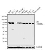 HK1 Antibody in Western Blot (WB)