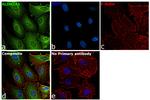 ALDH1A1 Antibody in Immunocytochemistry (ICC/IF)