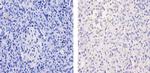 Glucocorticoid Receptor Antibody in Immunohistochemistry (Paraffin) (IHC (P))