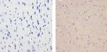 Glucocorticoid Receptor Antibody in Immunohistochemistry (Paraffin) (IHC (P))