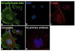 Alpha-Smooth Muscle Actin Antibody in Immunocytochemistry (ICC/IF)