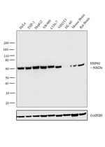 HSP60 Antibody in Western Blot (WB)