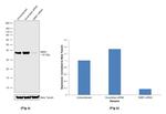 SMN1 Antibody in Western Blot (WB)