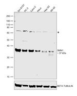 SMN1 Antibody in Western Blot (WB)