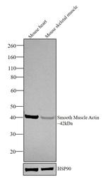 Alpha-Smooth Muscle Actin Antibody