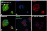 MMP9 Antibody