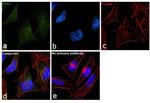 PKN2 Antibody in Immunocytochemistry (ICC/IF)