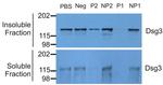 Desmoglein 3 Antibody in Western Blot (WB)