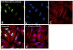 TERT Antibody in Immunocytochemistry (ICC/IF)