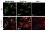 TERT Antibody in Immunocytochemistry (ICC/IF)