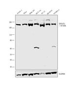 DNMT1 Antibody in Western Blot (WB)