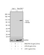 TLR2 Antibody in Western Blot (WB)