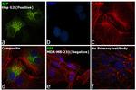 AFP Antibody