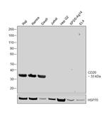 CD20 Antibody in Western Blot (WB)