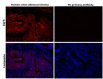 EGFR Antibody in Immunohistochemistry (Paraffin) (IHC (P))