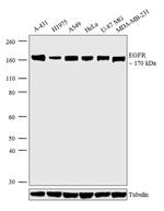 EGFR Antibody in Western Blot (WB)