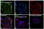 Cytokeratin 5 Antibody in Immunocytochemistry (ICC/IF)