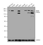 MSH6 Antibody in Western Blot (WB)