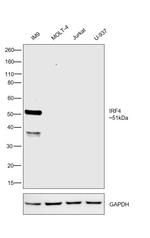 IRF4 Antibody in Western Blot (WB)