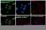 Progesterone Receptor Antibody