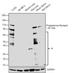 Progesterone Receptor Antibody