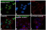 Progesterone Receptor Antibody in Immunocytochemistry (ICC/IF)