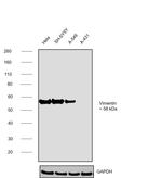 Vimentin Antibody