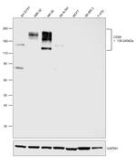 CD56 Antibody in Western Blot (WB)