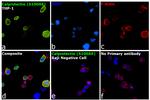 Calprotectin Antibody