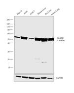 ALDH2 Antibody in Western Blot (WB)