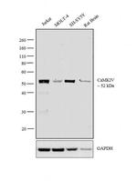 CaMKIV Antibody in Western Blot (WB)