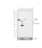 Cytokeratin 5 Antibody in Western Blot (WB)