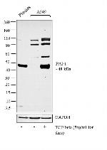 PAI1 Antibody in Western Blot (WB)