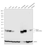 TAGLN Antibody