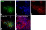 ADAR Antibody in Immunocytochemistry (ICC/IF)