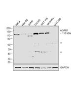 ADAR Antibody in Western Blot (WB)