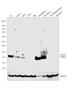 TAGLN Antibody