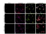 TGF beta-1 Antibody in Immunocytochemistry (ICC/IF)