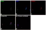 NOX2 Antibody in Immunocytochemistry (ICC/IF)