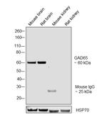 GAD65 Antibody in Western Blot (WB)