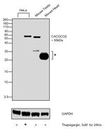 CALCOCO2 Antibody in Western Blot (WB)