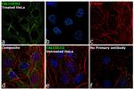 CALCOCO2 Antibody